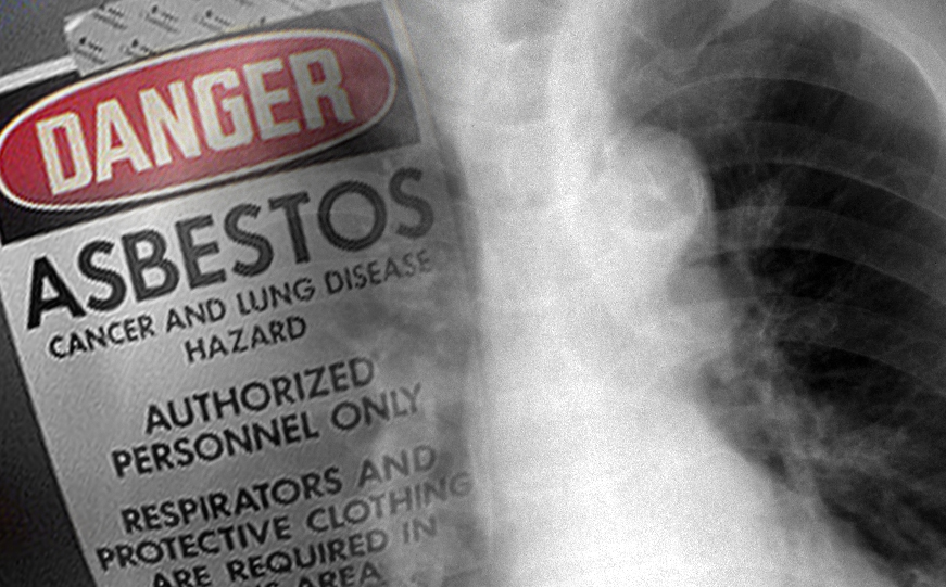 Is Asbestos Making A Comeback?